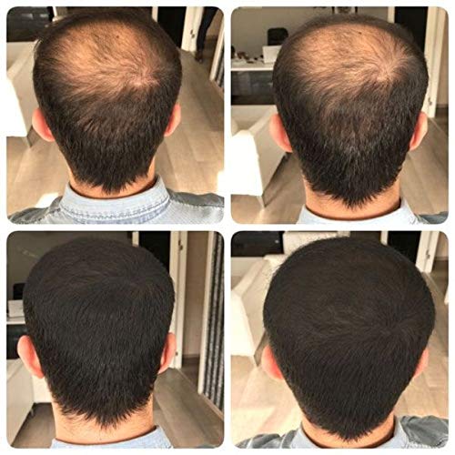 Hair Building